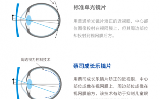 蔡司系列成长悦怎么样，蔡司成长悦好吗